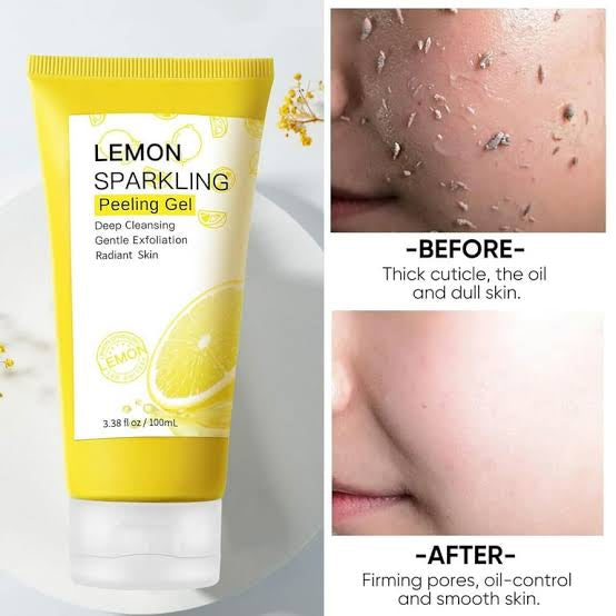 Mooyam Lemon Sparkling Peeling Gel Face Exfoliator, Brightening Facial Deep Exfoliating For All Skin Types